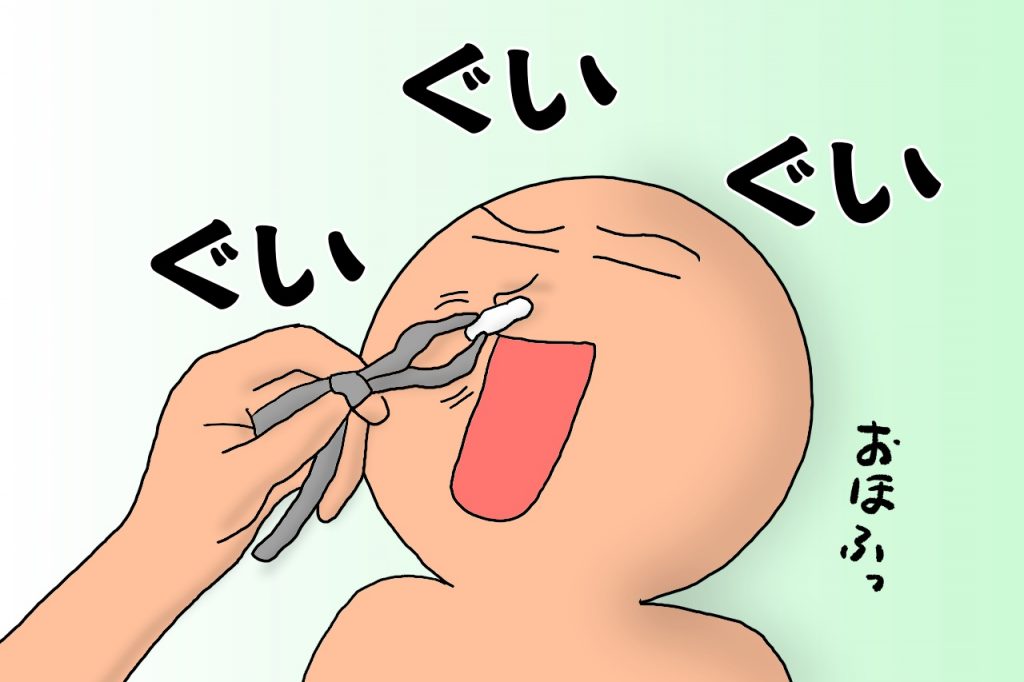 鼻の粘膜をレーザーで焼いたら思いのほか痛みがひどかった件 花粉症手術の体験談と術後の経過 鼻の粘膜をレーザーで焼いたら思いのほか痛みがひどかった件 花粉症手術の体験談と術後の経過